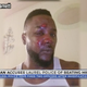 Illustration for article titled 2 Mississippi Police Officers Fired After Brutally Beating, Kicking Black Man